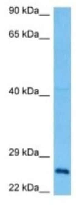 FAM60A Rabbit anti-Mouse, Polyclonal, Novus Biologicals 100 &mu;g | Buy Online | Novus Biologicals | Fisher Scientific